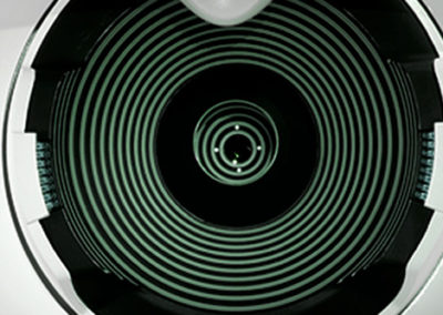 Aberrometria corneana