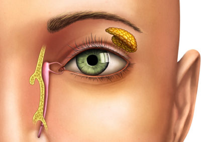 Análise de vias lacrimais