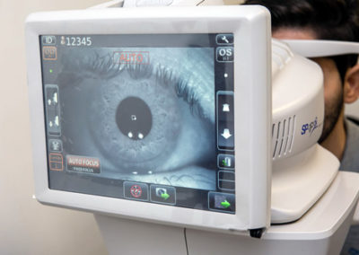 Microscopia especular de cornea